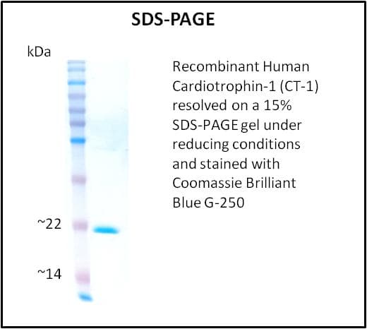 Human CTF1 / Cardiotrophin-1 Protein (Recombinant)