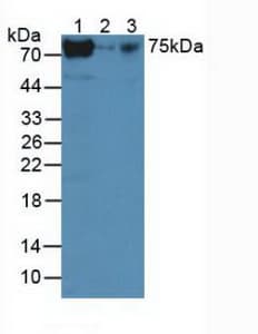 TERT / Telomerase Antibody (aa673-976)