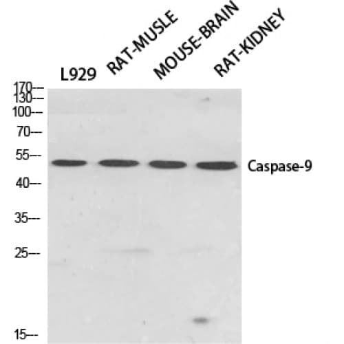 Polyclonal Rabbit anti-Human CASP9 / Caspase 9 Antibody (60-140 aa, IHC, IF, WB)