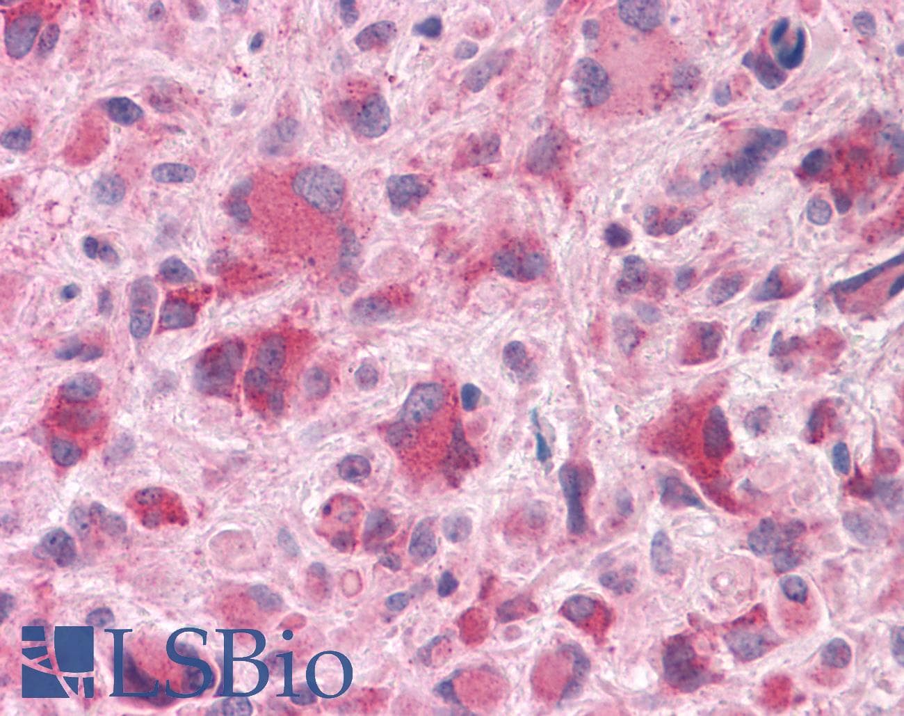 PathPlus™ HTR7 / 5HT7 Receptor Antibody (C-Terminus)