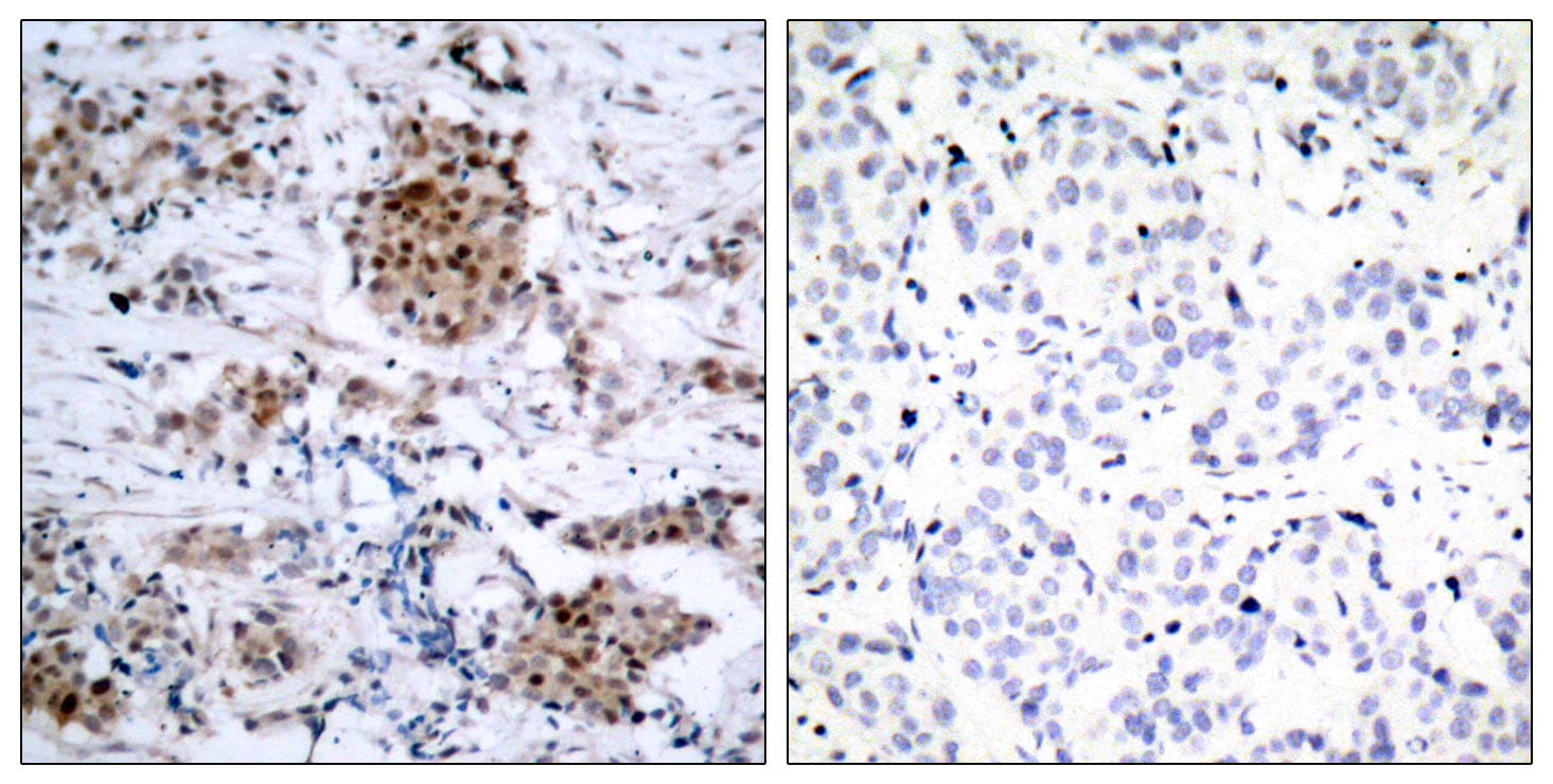 ER Alpha / Estrogen Receptor Antibody (phospho-Ser167)