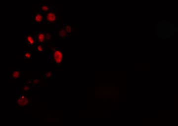 Polyclonal Rabbit anti-Human ZNF541 Antibody (IF, WB)