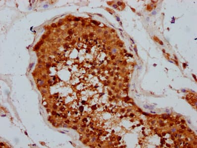 Polyclonal Rabbit anti-Human TSEN15 Antibody (IHC)