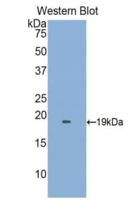 CCL2 / MCP1 Antibody (aa24-148)