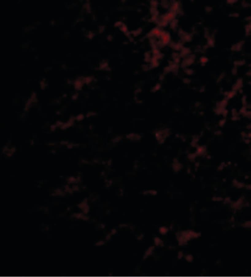 SLC9A1 / NHE1 Antibody