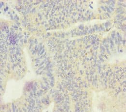 Polyclonal Rabbit anti-Human SCEH / ECHS1 Antibody (IHC, WB)