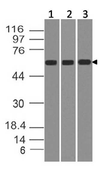 IL23R Antibody
