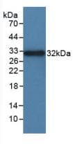 ITGAD / CD11d Antibody (aa879-1099, HRP)