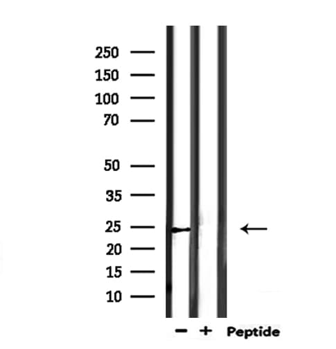 SCG5 / 7B2 Antibody
