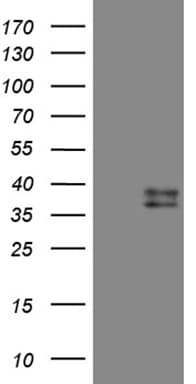 Monoclonal Mouse anti-Human CTSL / Cathepsin L Antibody (clone OTI2H2, Carrier-free, IHC, WB)