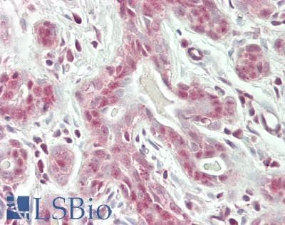 IHC-plus™ PPP6R3 / SAPS3 Antibody (aa400-450)