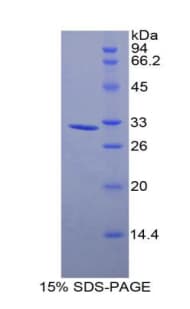 Mouse MYLK3 Protein (Recombinant His)