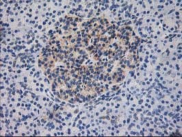 DLD / Diaphorase / E3 Antibody (clone OTI6D5)