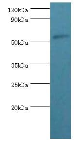 PSEN1 / Presenilin 1 Antibody (aa1-160)
