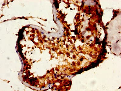 Polyclonal Rabbit anti-Human TIP49 / RUVBL1 Antibody