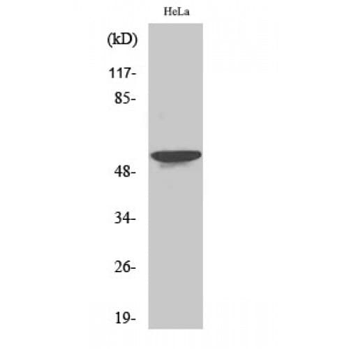 STK33 Antibody (N-Terminal)