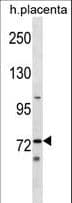 STKLD1 / SgK071 Antibody (aa137-165)