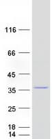 Human MRPL28 Protein (Recombinant Myc-DDK (Flag))