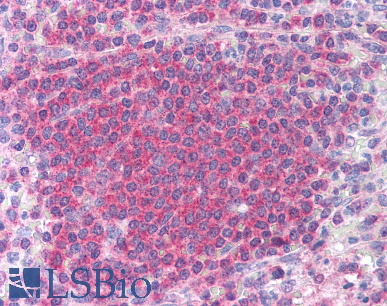 IHC-plus™ CHEK2 / CHK2 Antibody (clone 73C175.1.1)