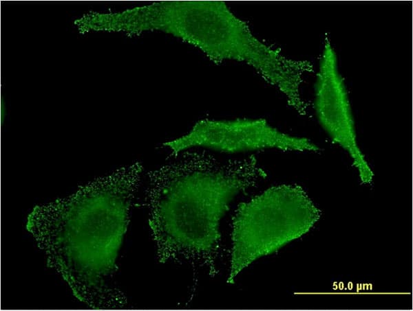 EREG / Epiregulin Antibody (clone 1E6)