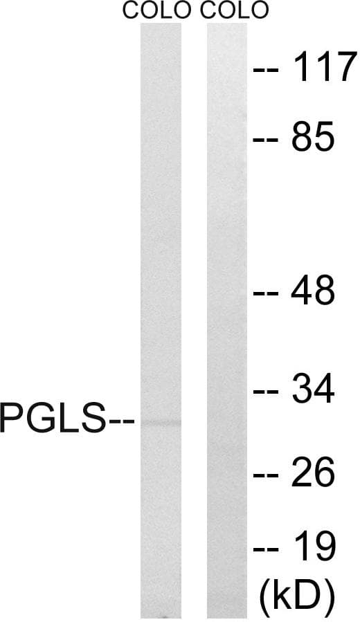 Polyclonal Rabbit anti-Human PGLS / 6PGL Antibody (IHC, WB)