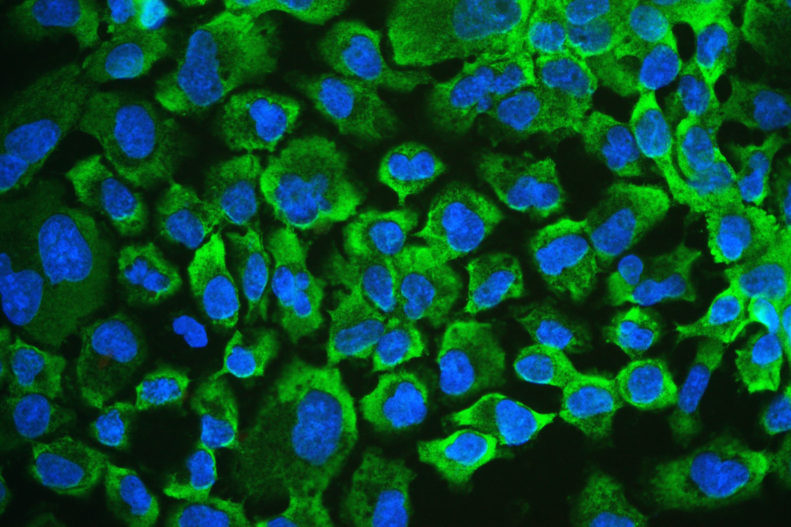 Polyclonal Rabbit anti-Human RENT1 / UPF1 Antibody (aa578-614, IHC, WB)