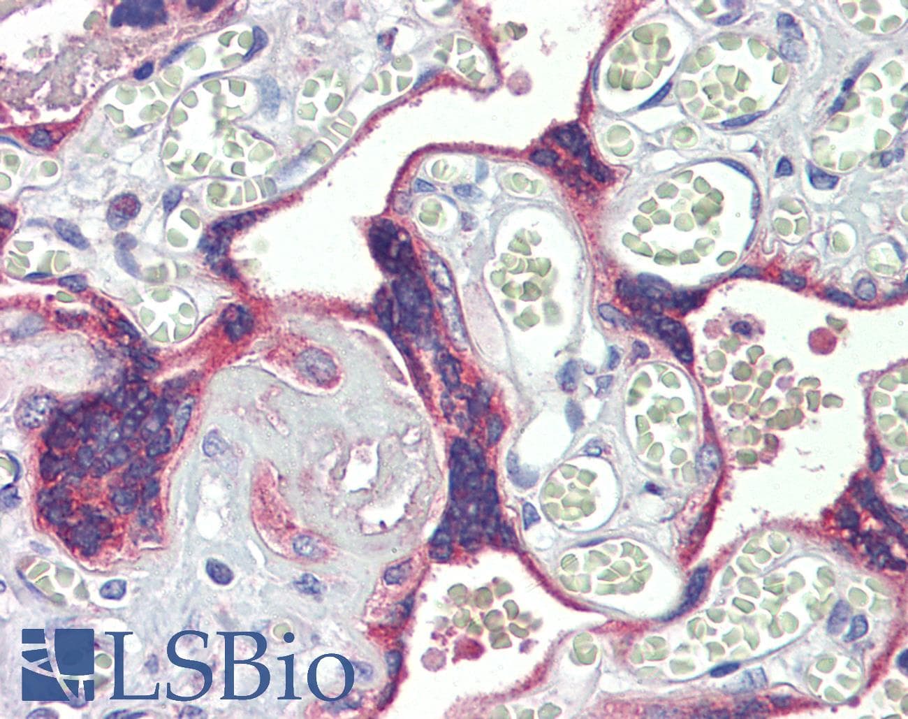 IHC-plus™ DSC3 / Desmocollin 3 Antibody (aa822-850)