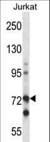 IHC-plus™ RAF1 / RAF Antibody (aa86-113)