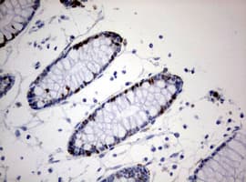 Monoclonal Mouse anti-Human MKI67 / Ki67 Antibody (clone OTI1F11, Carrier-free, aa1160-1493, IHC, WB)