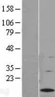 G0S2 Protein (Over-Expression Lysate Myc-DDK (Flag))