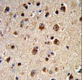 ADRBK2 / GRK3 Antibody (aa29-57)