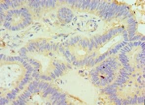 Polyclonal Rabbit anti-Human GLRX3 / Glutaredoxin 3 Antibody (aa1-335, IHC, WB)