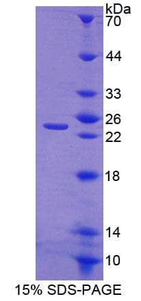 Human CHODL / Chondrolectin Protein (Recombinant His-T7)