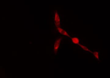 Polyclonal Rabbit anti-Human ZFP36L2 Antibody (IF, WB)