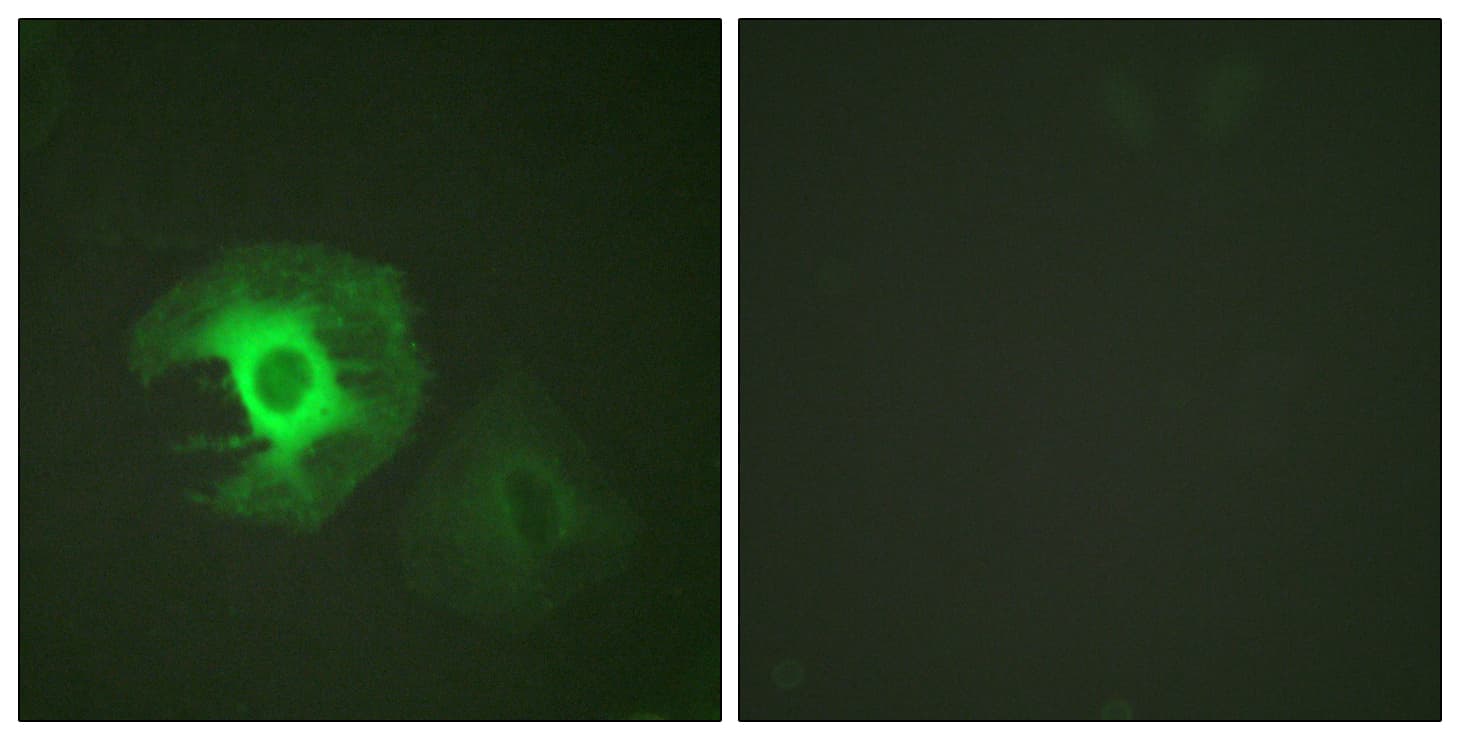 Polyclonal Rabbit anti-Human CALD1 / Caldesmon Antibody (aa744-793, IHC, IF, WB)