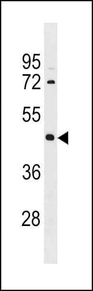 Polyclonal Rabbit anti-Human IRX1 Antibody (aa2-28, WB)