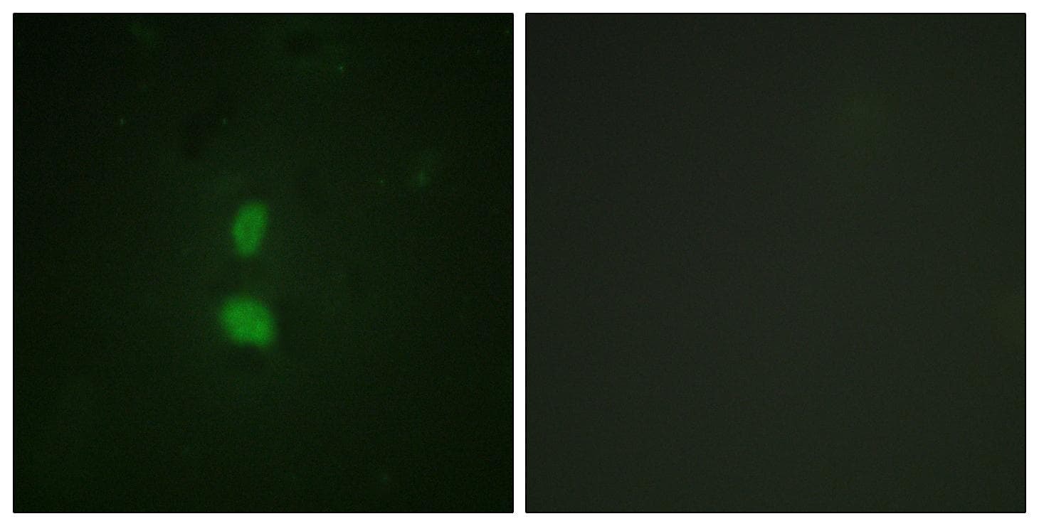 Polyclonal Rabbit anti-Human SNAI1 / SNAIL-1 Antibody (phospho-Ser246, IF, WB)