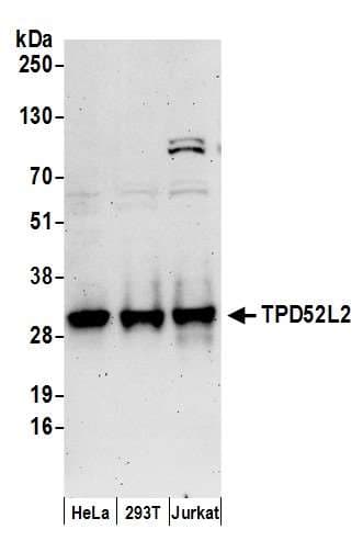Polyclonal Rabbit anti-Human TPD52L2 / HD54 Antibody (aa156-206, WB)