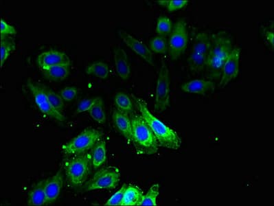 IHC-plus™ ODC1 / Ornithine Decarboxylase Antibody