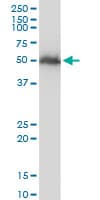 IHC-plus™ Monoclonal Mouse anti-Human TUBB2A / Tubulin Beta 2A Antibody (clone 3F9, IHC, IF, WB)