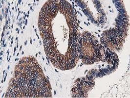 OSBP Antibody (clone OTI1F2)