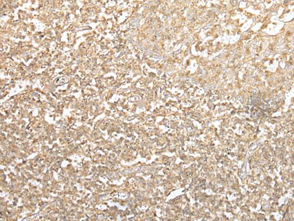 Polyclonal Rabbit anti-Human SPIC Antibody (IHC)