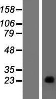 Human GAGEC1 / JM27 Protein (Over-Expression Lysate Myc-DDK (Flag))