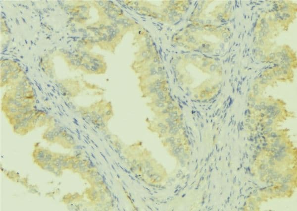LMOD1 Antibody