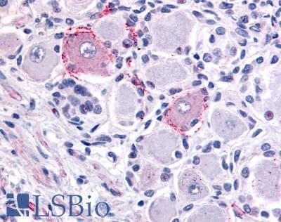 IHC-plus™ Polyclonal Rabbit anti-Human VRL1 / TRPV2 Antibody (Internal, IHC)