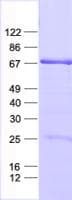 Human ZIM2 Protein (Recombinant His, N-Terminal)