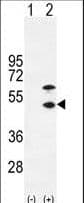 Polyclonal Rabbit anti-Human CKM / Creatine Kinase MM Antibody (aa1-30, WB)