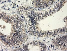 Monoclonal Mouse anti-Human EIF4E2 / IF4e Antibody (clone OTI1C1, IHC, WB)