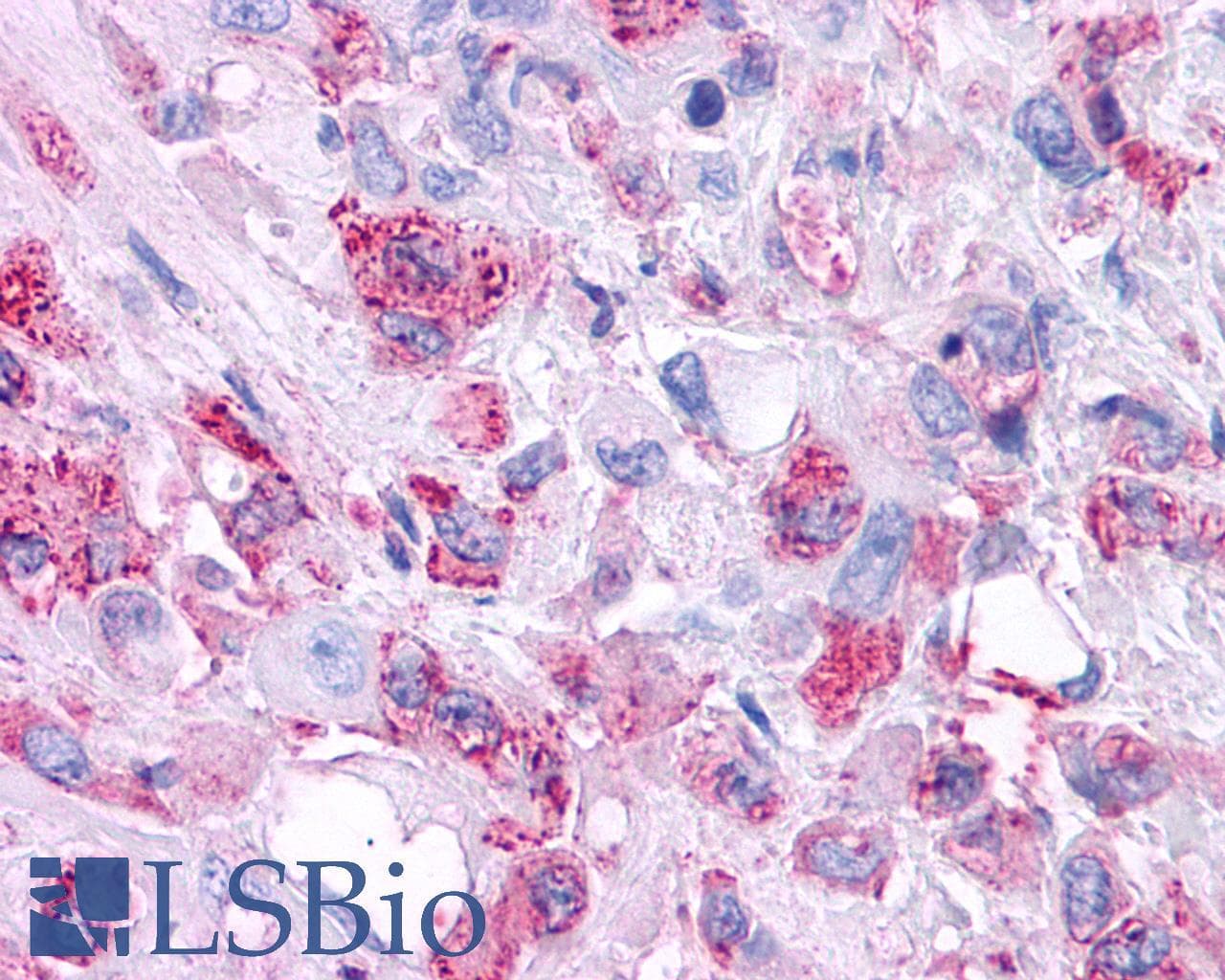 PathPlus™ Polyclonal Rabbit anti-Human VPAC2 / VIPR2 Antibody (C-Terminus, IHC)