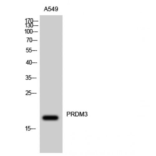 Polyclonal Rabbit anti-Human MECOM / EVI1 Antibody (1-80 aa, N-terminal, IHC, WB)